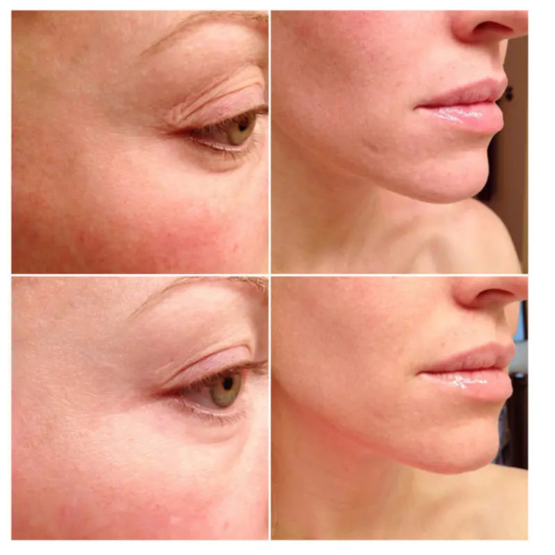 The Ordinary Multi-Peptide Serum - Anti-Aging / Reduces Wrinkles