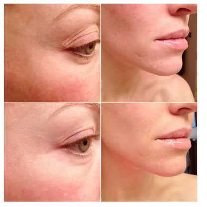 The Ordinary Multi-Peptide Serum - Anti-Aging / Reduces Wrinkles